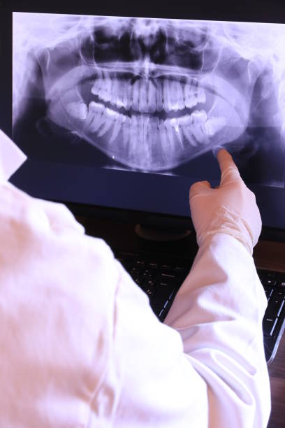 Best Emergency Dental Care for Abscessed Tooth in Crystal Springs, MS